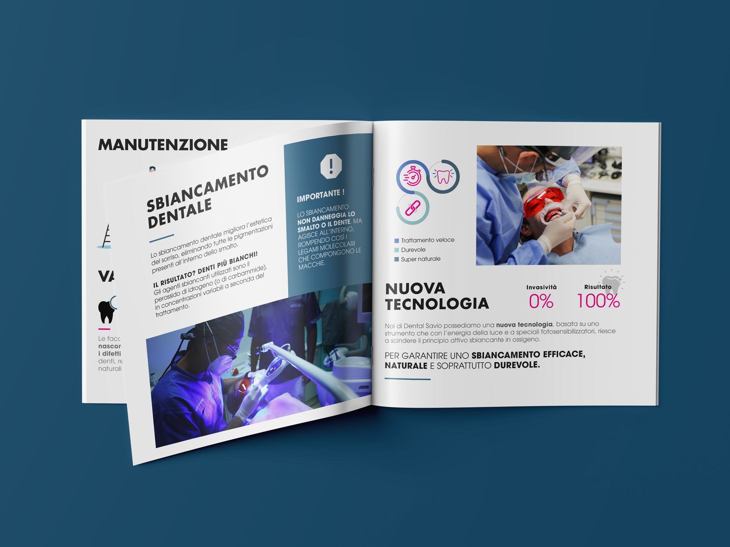 Brochure informativa sullo sbiancamento dentale